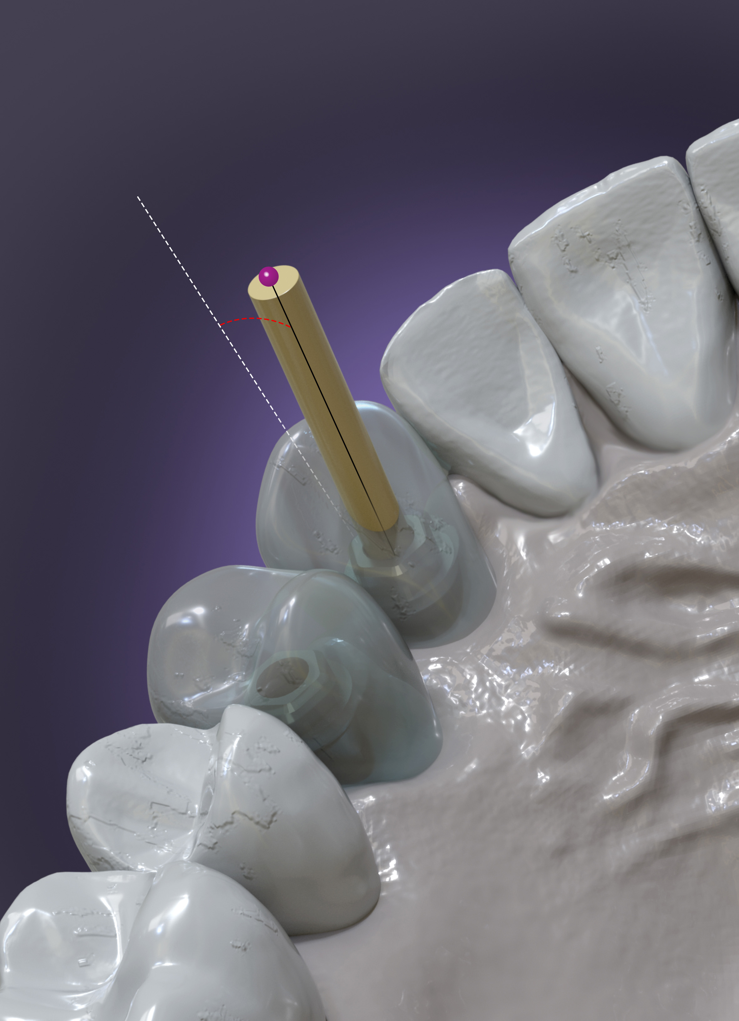 Digital Dentistry